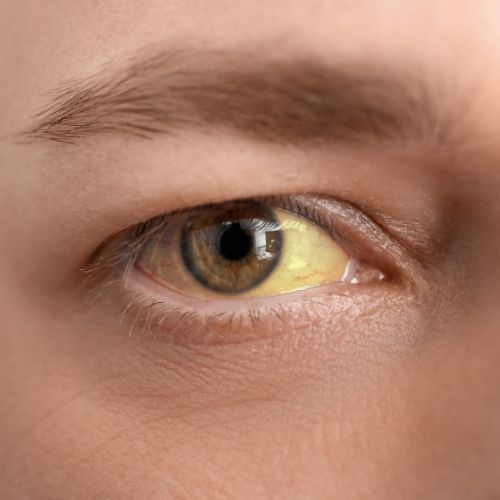 Hepatites autoimunes