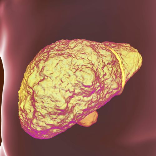 Cirroses e suas complicações